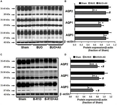 Inhibition of IL-1β by Aliskiren Improved Renal AQP2 Expression and Urinary Concentration Defect in Ureteral Obstruction and Release